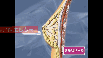 怎么丰胸最有效?