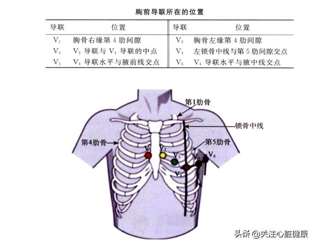 做心电图时导联位置若何安顿？