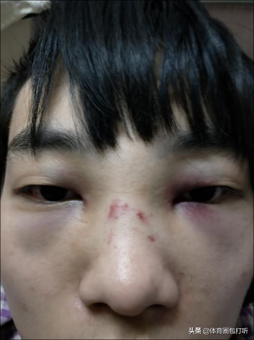 一兆韦德健身房打人最高赔多少<strong>一兆韦德健身管理有限公司</strong>？