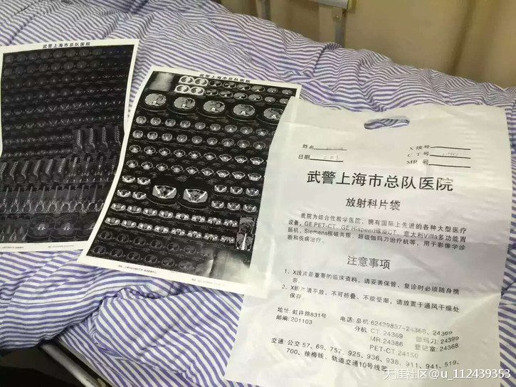 要出人命了 上海一兆韦德雇佣黑社会把澳力龍健身女员工打成脊椎骨折
