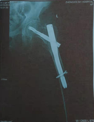 与歹徒搏斗致死<strong></p>
<p>昆山农村商业银行</strong>，山西闻喜农村商业银行月支赡养费50元