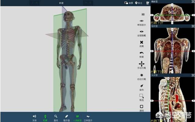 如何看待遗体被切片的“数字人”<strong></p>
<p>哈根斯生物塑化公司</strong>？