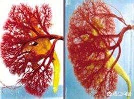 如何看待遗体被切片的“数字人”<strong></p>
<p>哈根斯生物塑化公司</strong>？