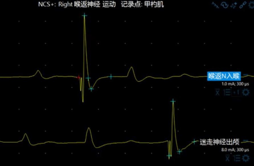 “臣妾做不到啊”，读这句话的时候，脑子里为什么有“声音”？