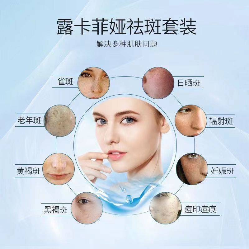 哪个牌子的祛斑霜效果最好?黄褐斑祛斑产品