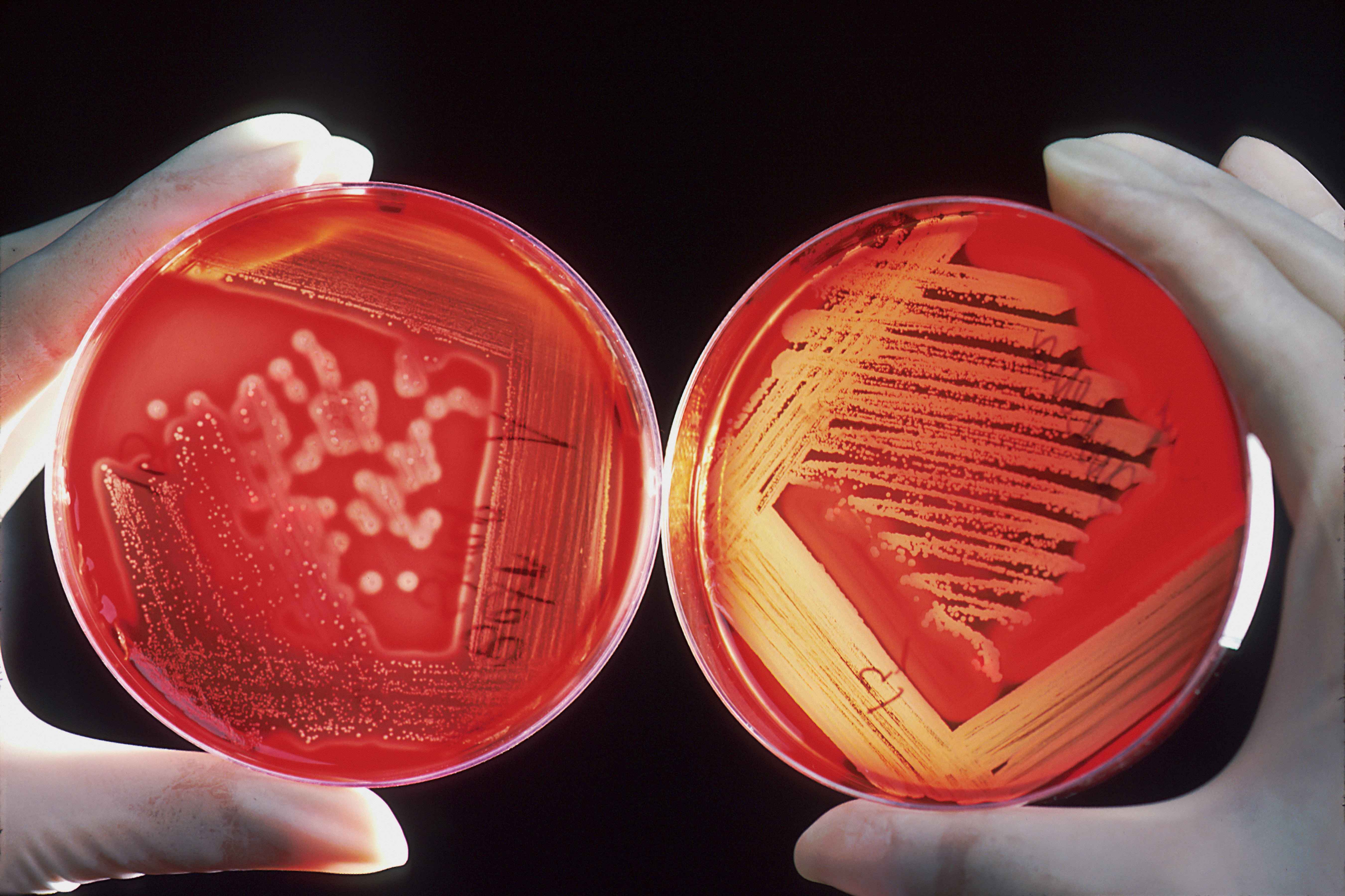 六类微生物（细菌、酵母、真菌、霉菌、放放线菌）常用培养基汇总