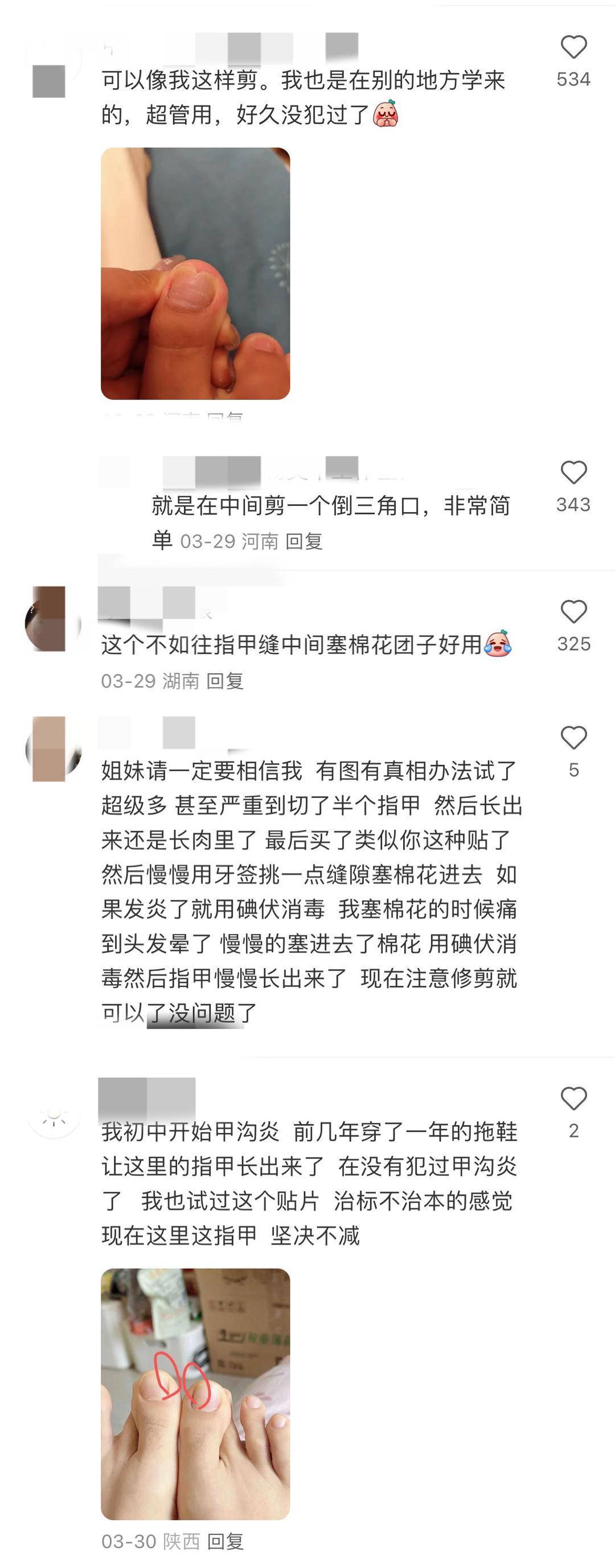 贴正甲片、修V口、塞棉花，真能让趾甲不往肉里长吗？|网红说法求真