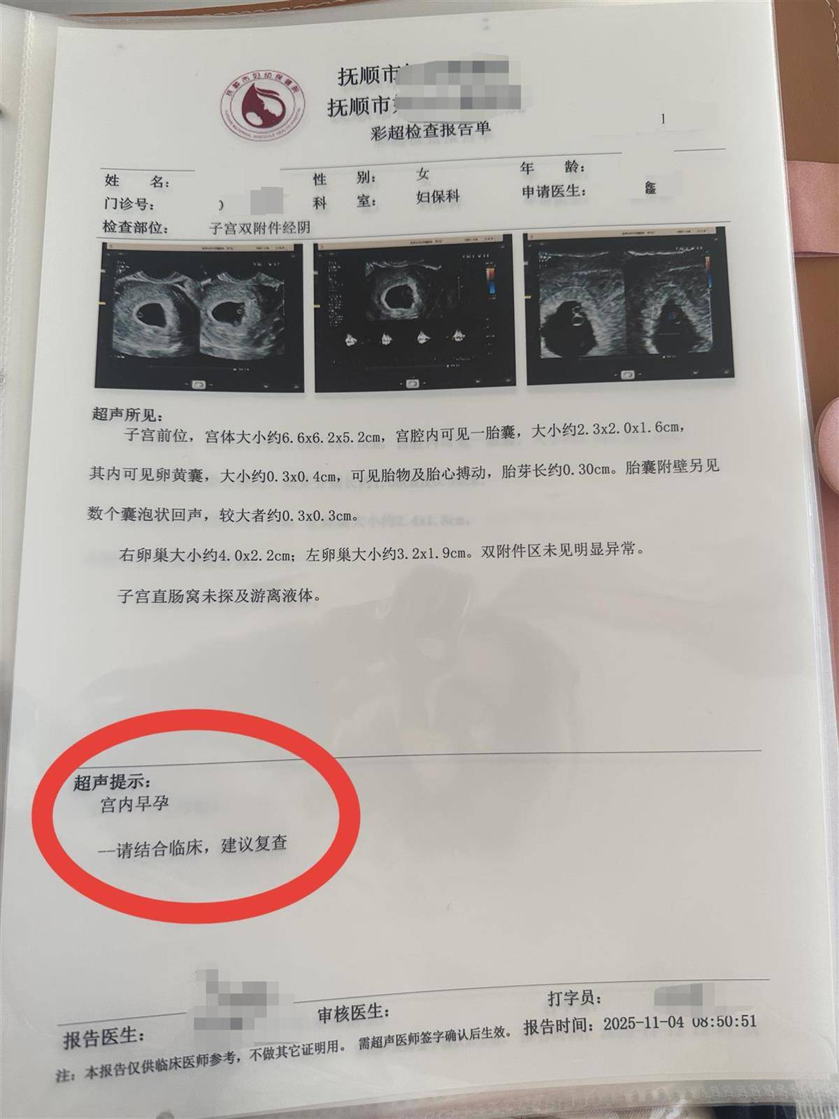 辽宁一孕妇两个月内从一胎变四胞胎，每次产检发现多出一胎，医生：系同卵四胞胎，概率1300万至1500万分之一