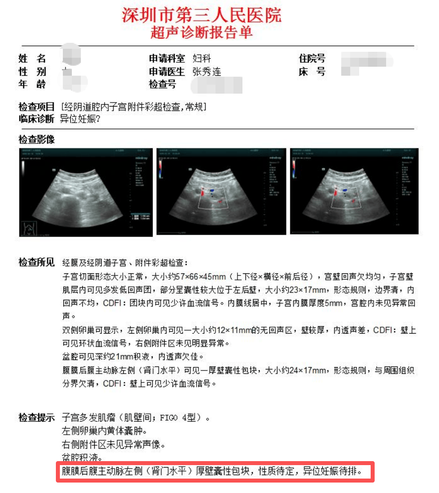 受精卵跑哪去了？女子怀孕照B超却怎么也找不到“宝宝”！一查惊了