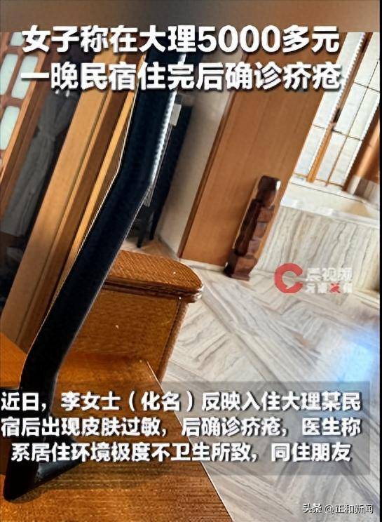 女子称在大理住5000多元一晚的民宿后过敏一个月确诊疥疮,沟通维权却被回复“如果需要不投诉以及不发帖,要给多少钱”,目前民宿拒绝采访