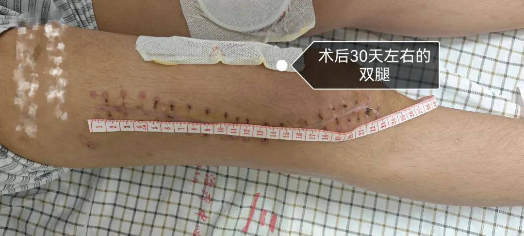 “被警棍追打，夜里绑在铁架床上”，14岁少年特训学校矫治网瘾，遭虐待双腿骨折学校隐瞒，医生发现异常果断报警