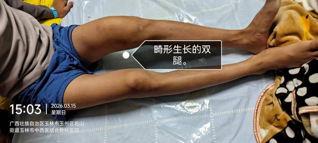 “被警棍追打，夜里绑在铁架床上”，14岁少年特训学校矫治网瘾，遭虐待双腿骨折学校隐瞒，医生发现异常果断报警